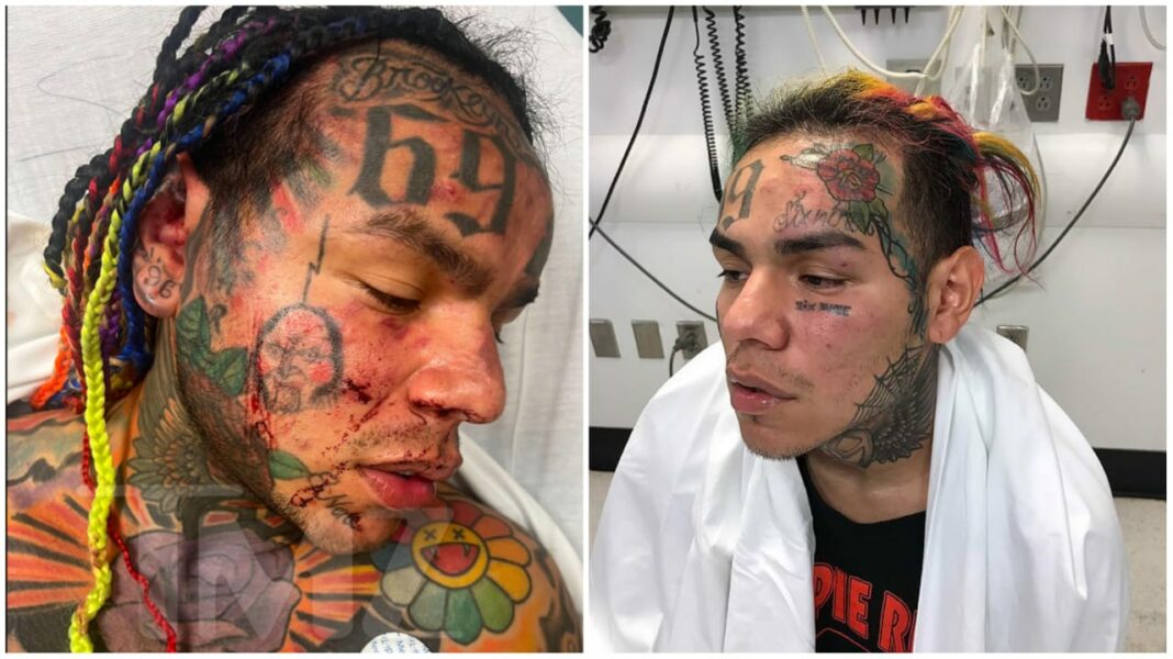 Tekashi 6ix9ine Severely Beaten In Ambush Attack In Gym Sauna Rushed To Hospital Video 1385